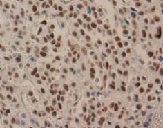 Immunohistochemical detection of Nucleolin on paraffin embedded section of human stomach with AM26580AF-N. Immunohistochemical detection of Nucleolin on paraffin embedded section of human stomach with AM26580AF-N.