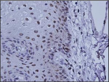 Immunohistochemical detection on DNA Topoisomerase II alpha on paraffin embedded section of human stomach with AM26595AF-N Immunohistochemical detection on DNA Topoisomerase II alpha on paraffin embedded section of human stomach with AM26595AF-N