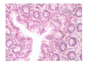 Immunohistochemistry of formalin-fixed, paraffin-embedded human small intestine at 20 microg/ml using anti-GPR49 antibody Cat.No. SP4729P.