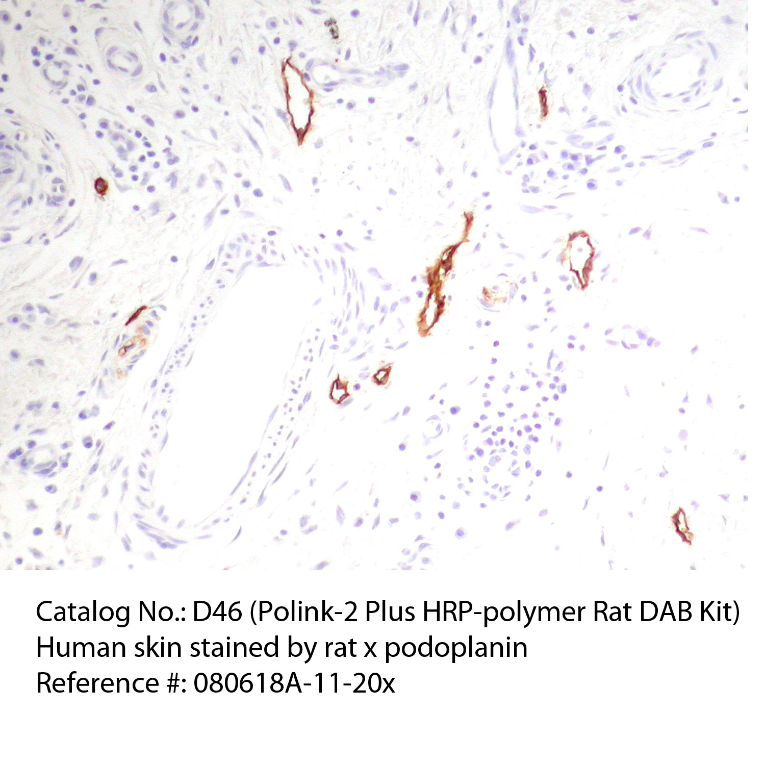 IHC staining of FFPE human skin tissue within normal limits using rat anti-podoplanin polyclonal antibody and Polink-2 Plus HRP Rat NM for DAB detection kit [D46-18]. The brown stain indicates positive stain and blue is the counter stain. It is mounted using a permanent organic mounting medium [E37-100].