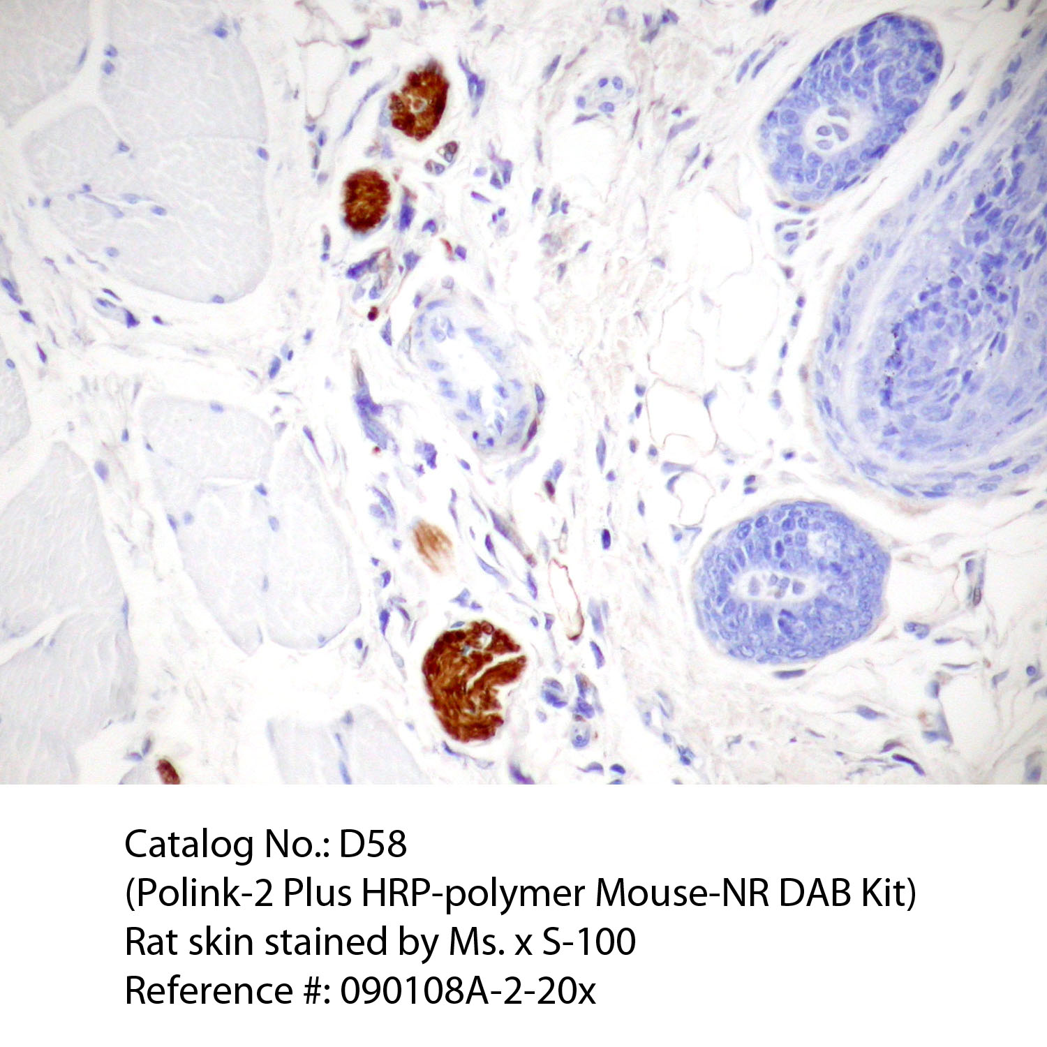 IHC staining of FFPE rat skin tissue within normal limits using mouse anti-S-100 polyclonal antibody and Polink-2 Plus HRP Mouse-NR for DAB detection kit [D58-18]. The brown stain indicates positive stain and blue is the counter stain. It is mounted using a permanent organic mounting medium [E37-100].