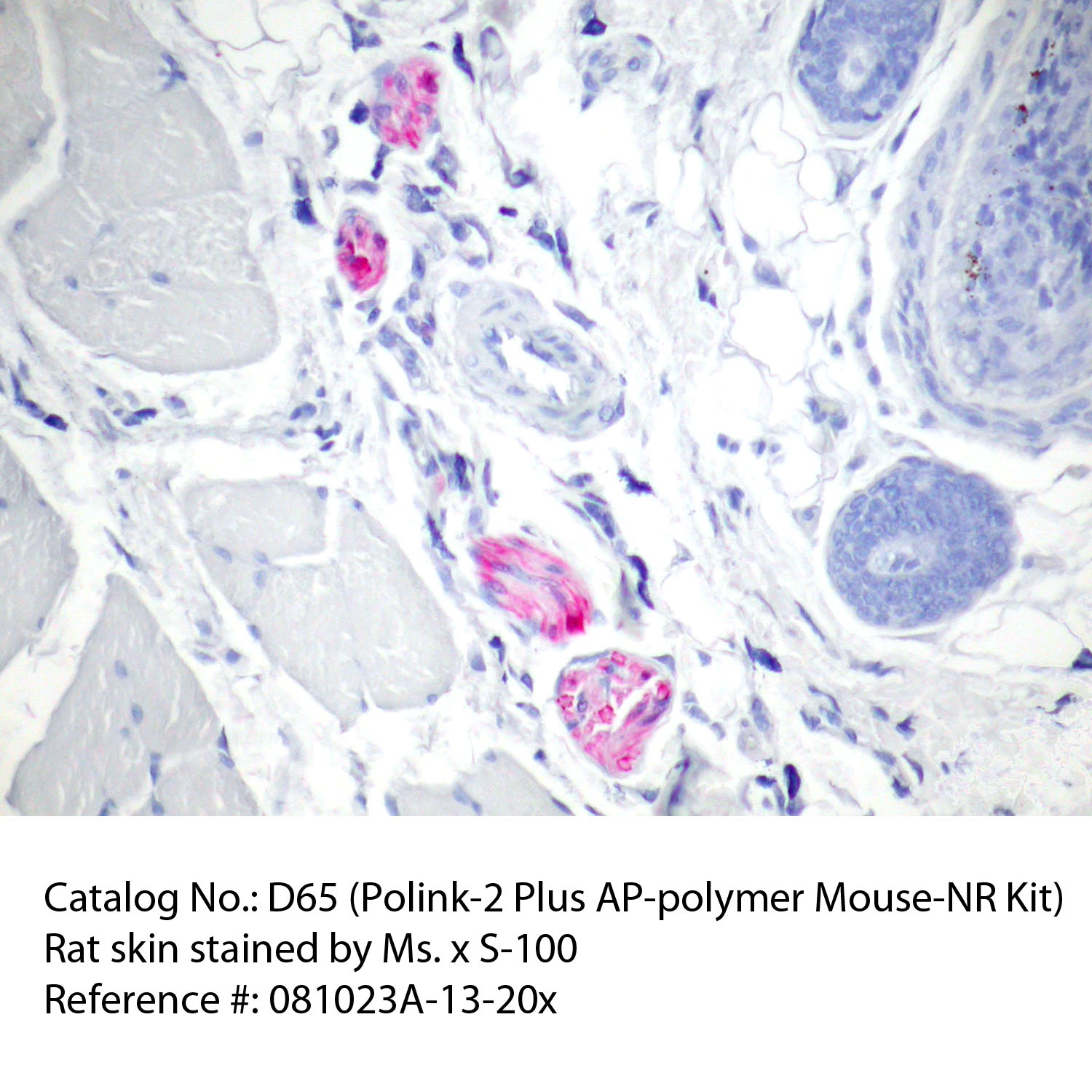 IHC staining of FFPE rat skin tissue within normal limits using mouse anti-S-100 polyclonal antibody and Polink-2 Plus AP Mouse-NR detection kit [D65-18]. The red stain indicates positive stain and blue is the counter stain. It is mounted using a permanent aqueous mounting medium [E03-18].