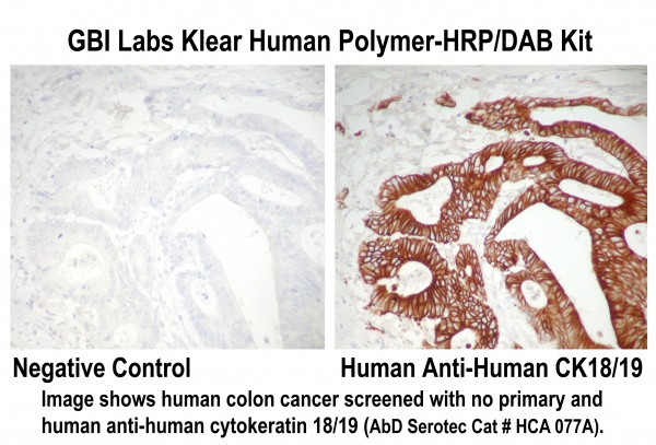 Klear Human HRP-Polymer DAB Detection Kit