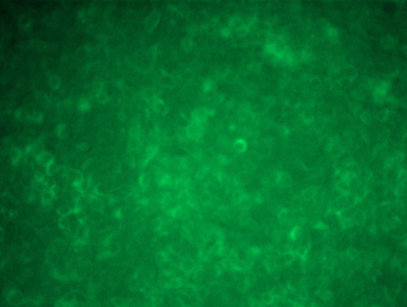 MR200474L4 was used to prepare Lentiviral particles using TR30037 packaging kit. HEK293T cells were transduced with MR200474L4V particle to overexpress human Tyrobp-mGFP fusion protein.