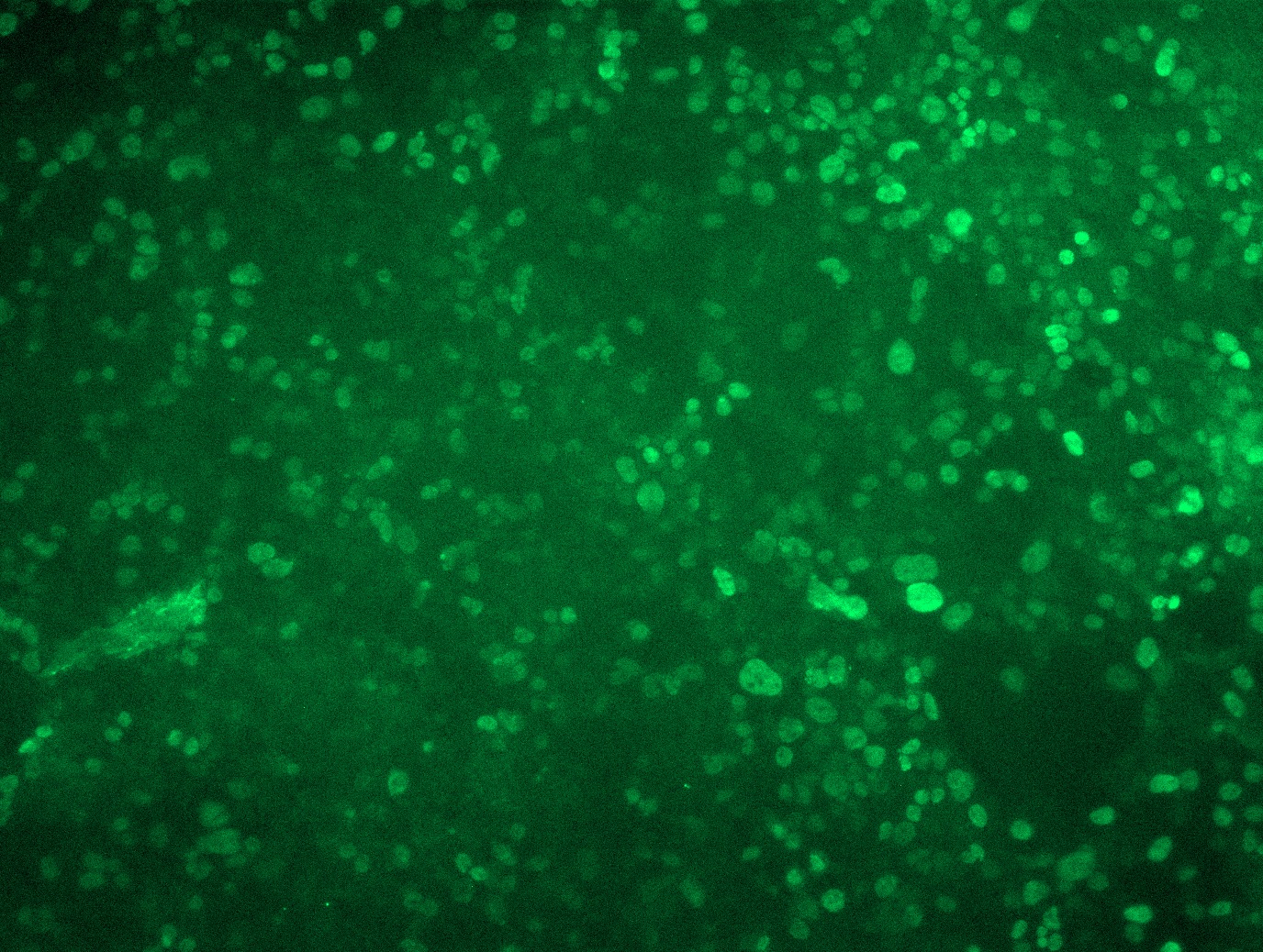 MR210894L3 was used to prepare Lentiviral particles using TR30037 packaging kit. HEK293T cells were transduced with MR210894L3V particle to overexpress human Zhx2-Myc-DDK fusion protein.