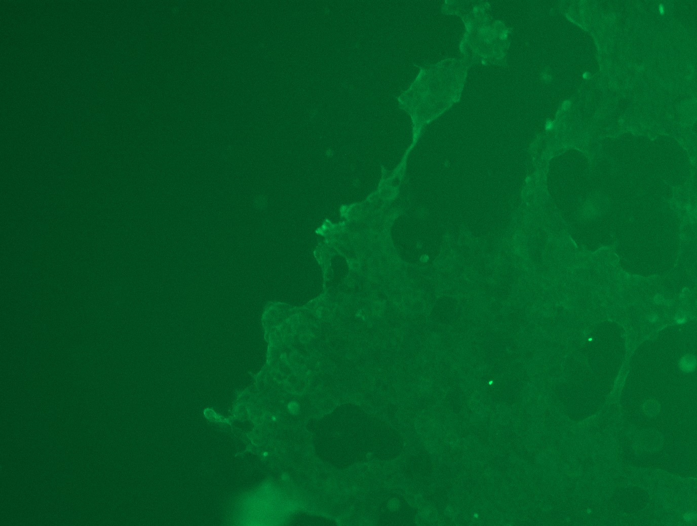 RC209996L3 was used to prepare Lentiviral particles using TR30037 packaging kit. HEK293T cells were transduced with RC209996L3V particle to overexpress human CRTAM-Myc-DDK fusion protein.