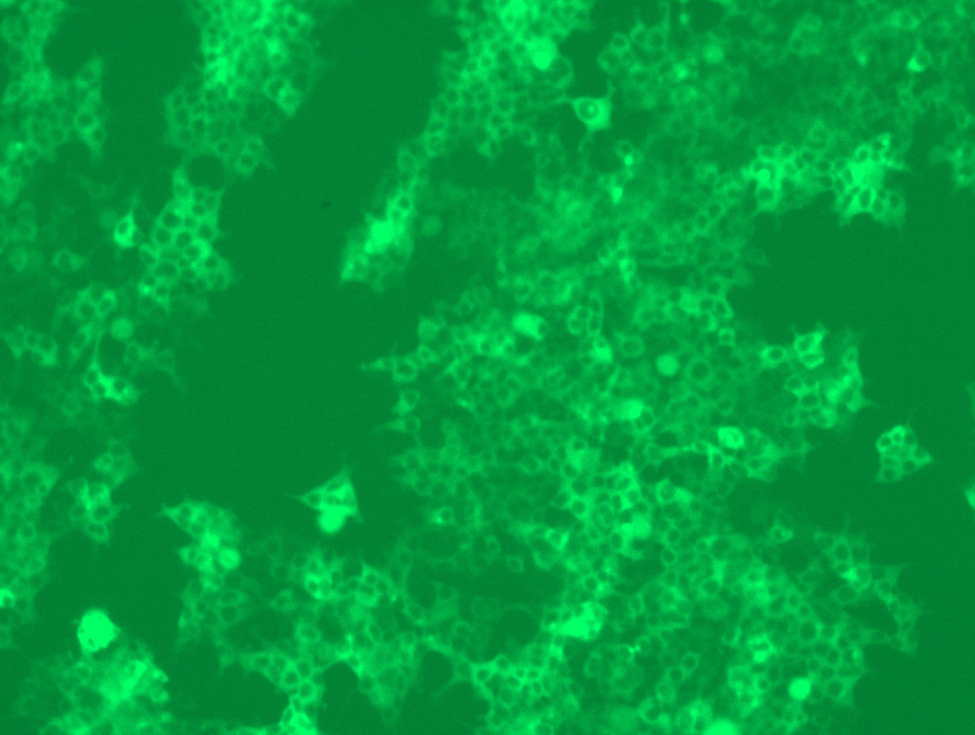 MR209904L4 was used to prepare Lentiviral particles using TR30037 packaging kit. HEK293T cells were transduced with MR209904L4V particle to overexpress human Limd1-mGFP fusion protein.