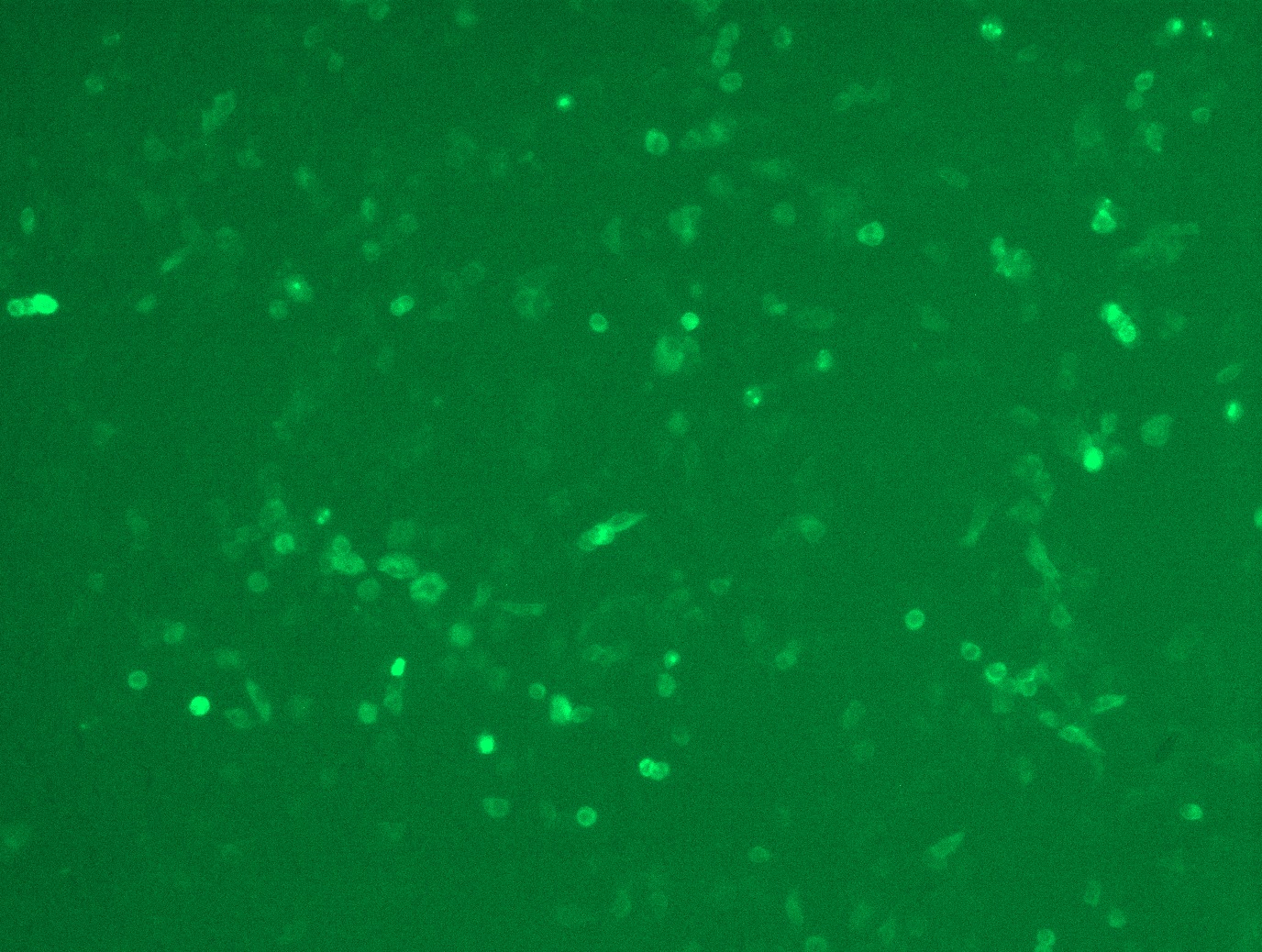 MR210770L4 was used to prepare Lentiviral particles using TR30037 packaging kit. HEK293T cells were transduced with MR210770L4V particle to overexpress human Dlgap5-mGFP fusion protein.