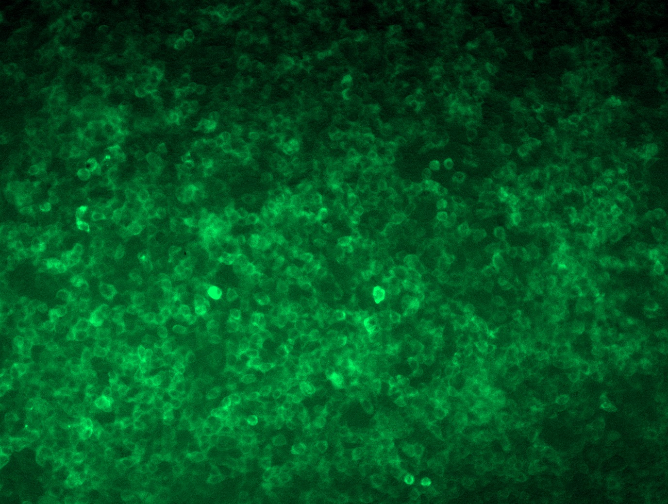 MR210985L4 was used to prepare Lentiviral particles using TR30037 packaging kit. HEK293T cells were transduced with MR210985L4V particle to overexpress human Mvp-mGFP fusion protein.