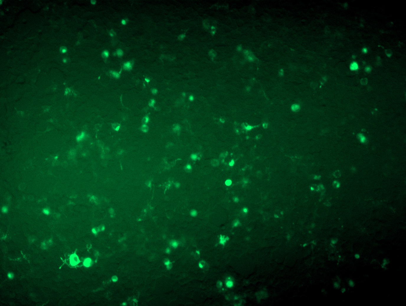 MR211616L4 was used to prepare Lentiviral particles using TR30037 packaging kit. HEK293T cells were transduced with MR211616L4V particle to overexpress human Pdgfra-mGFP fusion protein.