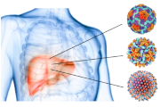 hepatitis image