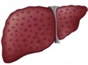 Hepatitis image