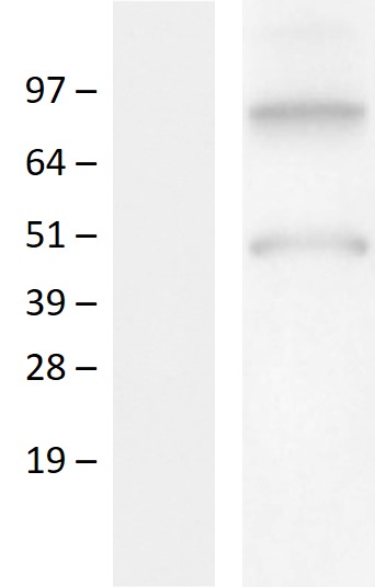 Western blot validation of overexpression lysate (Cat# LY432878) using anti-DDK antibody (Cat# TA50011-100). Left: Cell lysates from un-transfected HEK293T cells; Right: Cell lysates from HEK293T cells transfected with RC229878 using transfection reagent MegaTran 2.0 (Cat# TT210002).