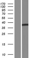 Western blot validation of overexpression lysate (Cat# LY424210) using anti-DDK antibody (Cat# TA50011-100). Left: Cell lysates from un-transfected HEK293T cells; Right: Cell lysates from HEK293T cells transfected with RC221984 using transfection reagent MegaTran 2.0 (Cat# TT210002).