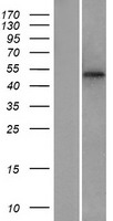 Western blot validation of overexpression lysate (Cat# LY433139) using anti-DDK antibody (Cat# TA50011-100). Left: Cell lysates from un-transfected HEK293T cells; Right: Cell lysates from HEK293T cells transfected with RC230139 using transfection reagent MegaTran 2.0 (Cat# TT210002).