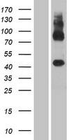 Western blot validation of overexpression lysate (Cat# LY420474) using anti-DDK antibody (Cat# TA50011-100). Left: Cell lysates from un-transfected HEK293T cells; Right: Cell lysates from HEK293T cells transfected with RC218990 using transfection reagent MegaTran 2.0 (Cat# TT210002).