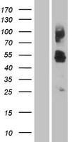 Western blot validation of overexpression lysate (Cat# LY409054) using anti-DDK antibody (Cat# TA50011-100). Left: Cell lysates from un-transfected HEK293T cells; Right: Cell lysates from HEK293T cells transfected with RC214417 using transfection reagent MegaTran 2.0 (Cat# TT210002).