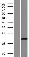 Western blot validation of overexpression lysate (Cat# LY433981) using anti-DDK antibody (Cat# TA50011-100). Left: Cell lysates from un-transfected HEK293T cells; Right: Cell lysates from HEK293T cells transfected with RC230982 using transfection reagent MegaTran 2.0 (Cat# TT210002).
