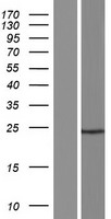 Western blot validation of overexpression lysate (Cat# LY427890) using anti-DDK antibody (Cat# TA50011-100). Left: Cell lysates from un-transfected HEK293T cells; Right: Cell lysates from HEK293T cells transfected with RC227178 using transfection reagent MegaTran 2.0 (Cat# TT210002).