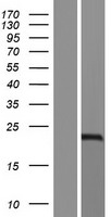 Western blot validation of overexpression lysate (Cat# LY434023) using anti-DDK antibody (Cat# TA50011-100). Left: Cell lysates from un-transfected HEK293T cells; Right: Cell lysates from HEK293T cells transfected with RC231024 using transfection reagent MegaTran 2.0 (Cat# TT210002).