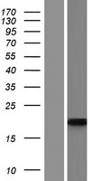 Western blot validation of overexpression lysate (Cat# LY431117) using anti-DDK antibody (Cat# TA50011-100). Left: Cell lysates from un-transfected HEK293T cells; Right: Cell lysates from HEK293T cells transfected with RC228089 using transfection reagent MegaTran 2.0 (Cat# TT210002).