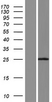 Western blot validation of overexpression lysate (Cat# LY406533) using anti-DDK antibody (Cat# TA50011-100). Left: Cell lysates from un-transfected HEK293T cells; Right: Cell lysates from HEK293T cells transfected with RC218222 using transfection reagent MegaTran 2.0 (Cat# TT210002).
