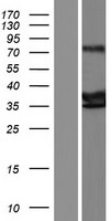 Western blot validation of overexpression lysate (Cat# LY423190) using anti-DDK antibody (Cat# TA50011-100). Left: Cell lysates from un-transfected HEK293T cells; Right: Cell lysates from HEK293T cells transfected with RC218981 using transfection reagent MegaTran 2.0 (Cat# TT210002).