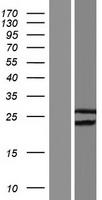 Western blot validation of overexpression lysate (Cat# LY421129) using anti-DDK antibody (Cat# TA50011-100). Left: Cell lysates from un-transfected HEK293T cells; Right: Cell lysates from HEK293T cells transfected with RC224732 using transfection reagent MegaTran 2.0 (Cat# TT210002).
