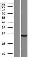 Western blot validation of overexpression lysate (Cat# LY404763) using anti-DDK antibody (Cat# TA50011-100). Left: Cell lysates from un-transfected HEK293T cells; Right: Cell lysates from HEK293T cells transfected with RC221937 using transfection reagent MegaTran 2.0 (Cat# TT210002).