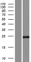 Western blot validation of overexpression lysate (Cat# LY422099) using anti-DDK antibody (Cat# TA50011-100). Left: Cell lysates from un-transfected HEK293T cells; Right: Cell lysates from HEK293T cells transfected with RC215200 using transfection reagent MegaTran 2.0 (Cat# TT210002).
