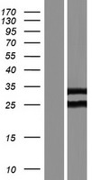 Western blot validation of overexpression lysate (Cat# LY423329) using anti-DDK antibody (Cat# TA50011-100). Left: Cell lysates from un-transfected HEK293T cells; Right: Cell lysates from HEK293T cells transfected with RC222170 using transfection reagent MegaTran 2.0 (Cat# TT210002).