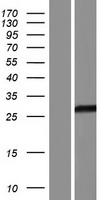 Western blot validation of overexpression lysate (Cat# LY434044) using anti-DDK antibody (Cat# TA50011-100). Left: Cell lysates from un-transfected HEK293T cells; Right: Cell lysates from HEK293T cells transfected with RC231045 using transfection reagent MegaTran 2.0 (Cat# TT210002).