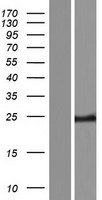 Western blot validation of overexpression lysate (Cat# LY421803) using anti-DDK antibody (Cat# TA50011-100). Left: Cell lysates from un-transfected HEK293T cells; Right: Cell lysates from HEK293T cells transfected with RC216594 using transfection reagent MegaTran 2.0 (Cat# TT210002).
