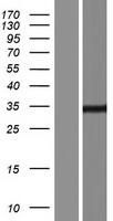 Western blot validation of overexpression lysate (Cat# LY414579) using anti-DDK antibody (Cat# TA50011-100). Left: Cell lysates from un-transfected HEK293T cells; Right: Cell lysates from HEK293T cells transfected with RC215184 using transfection reagent MegaTran 2.0 (Cat# TT210002).