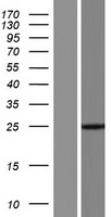 Western blot validation of overexpression lysate (Cat# LY421520) using anti-DDK antibody (Cat# TA50011-100). Left: Cell lysates from un-transfected HEK293T cells; Right: Cell lysates from HEK293T cells transfected with RC216675 using transfection reagent MegaTran 2.0 (Cat# TT210002).