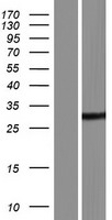 Western blot validation of overexpression lysate (Cat# LY431187) using anti-DDK antibody (Cat# TA50011-100). Left: Cell lysates from un-transfected HEK293T cells; Right: Cell lysates from HEK293T cells transfected with RC228159 using transfection reagent MegaTran 2.0 (Cat# TT210002).