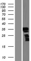 Western blot validation of overexpression lysate (Cat# LY421146) using anti-DDK antibody (Cat# TA50011-100). Left: Cell lysates from un-transfected HEK293T cells; Right: Cell lysates from HEK293T cells transfected with RC220283 using transfection reagent MegaTran 2.0 (Cat# TT210002).