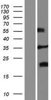 Western blot validation of overexpression lysate (Cat# LY423808) using anti-DDK antibody (Cat# TA50011-100). Left: Cell lysates from un-transfected HEK293T cells; Right: Cell lysates from HEK293T cells transfected with RC216000 using transfection reagent MegaTran 2.0 (Cat# TT210002).