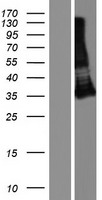 Western blot validation of overexpression lysate (Cat# LY404232) using anti-DDK antibody (Cat# TA50011-100). Left: Cell lysates from un-transfected HEK293T cells; Right: Cell lysates from HEK293T cells transfected with RC223761 using transfection reagent MegaTran 2.0 (Cat# TT210002).