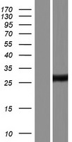 Western blot validation of overexpression lysate (Cat# LY420814) using anti-DDK antibody (Cat# TA50011-100). Left: Cell lysates from un-transfected HEK293T cells; Right: Cell lysates from HEK293T cells transfected with RC212872 using transfection reagent MegaTran 2.0 (Cat# TT210002).