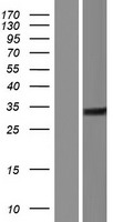 Western blot validation of overexpression lysate (Cat# LY423100) using anti-DDK antibody (Cat# TA50011-100). Left: Cell lysates from un-transfected HEK293T cells; Right: Cell lysates from HEK293T cells transfected with RC223004 using transfection reagent MegaTran 2.0 (Cat# TT210002).