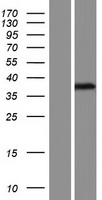 Western blot validation of overexpression lysate (Cat# LY406295) using anti-DDK antibody (Cat# TA50011-100). Left: Cell lysates from un-transfected HEK293T cells; Right: Cell lysates from HEK293T cells transfected with RC224353 using transfection reagent MegaTran 2.0 (Cat# TT210002).