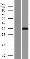 Western blot validation of overexpression lysate (Cat# LY431246) using anti-DDK antibody (Cat# TA50011-100). Left: Cell lysates from un-transfected HEK293T cells; Right: Cell lysates from HEK293T cells transfected with RC228218 using transfection reagent MegaTran 2.0 (Cat# TT210002).