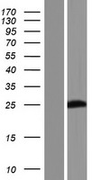 Western blot validation of overexpression lysate (Cat# LY420947) using anti-DDK antibody (Cat# TA50011-100). Left: Cell lysates from un-transfected HEK293T cells; Right: Cell lysates from HEK293T cells transfected with RC224446 using transfection reagent MegaTran 2.0 (Cat# TT210002).