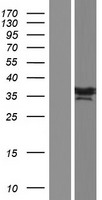 Western blot validation of overexpression lysate (Cat# LY421279) using anti-DDK antibody (Cat# TA50011-100). Left: Cell lysates from un-transfected HEK293T cells; Right: Cell lysates from HEK293T cells transfected with RC222073 using transfection reagent MegaTran 2.0 (Cat# TT210002).