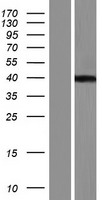 Western blot validation of overexpression lysate (Cat# LY434144) using anti-DDK antibody (Cat# TA50011-100). Left: Cell lysates from un-transfected HEK293T cells; Right: Cell lysates from HEK293T cells transfected with RC231145 using transfection reagent MegaTran 2.0 (Cat# TT210002).