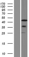 Western blot validation of overexpression lysate (Cat# LY420345) using anti-DDK antibody (Cat# TA50011-100). Left: Cell lysates from un-transfected HEK293T cells; Right: Cell lysates from HEK293T cells transfected with RC216253 using transfection reagent MegaTran 2.0 (Cat# TT210002).