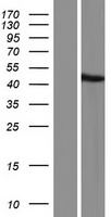 Western blot validation of overexpression lysate (Cat# LY420670) using anti-DDK antibody (Cat# TA50011-100). Left: Cell lysates from un-transfected HEK293T cells; Right: Cell lysates from HEK293T cells transfected with RC215415 using transfection reagent MegaTran 2.0 (Cat# TT210002).
