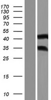 Western blot validation of overexpression lysate (Cat# LY434196) using anti-DDK antibody (Cat# TA50011-100). Left: Cell lysates from un-transfected HEK293T cells; Right: Cell lysates from HEK293T cells transfected with RC231197 using transfection reagent MegaTran 2.0 (Cat# TT210002).