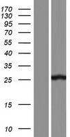 Western blot validation of overexpression lysate (Cat# LY406982) using anti-DDK antibody (Cat# TA50011-100). Left: Cell lysates from un-transfected HEK293T cells; Right: Cell lysates from HEK293T cells transfected with RC213257 using transfection reagent MegaTran 2.0 (Cat# TT210002).